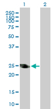 ADH6 purified MaxPab rabbit polyclonal antibody (D01P)