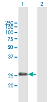 ADH6 purified MaxPab mouse polyclonal antibody (B01P)