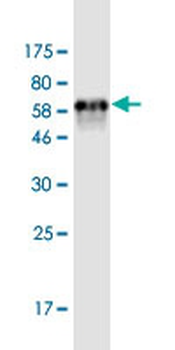 ADH5 monoclonal antibody (M12), clone 2D11