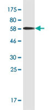 ADH5 monoclonal antibody (M01), clone 12F7