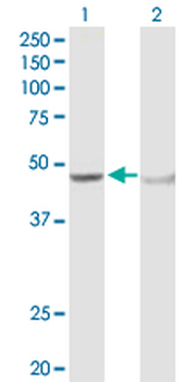 ADH5 purified MaxPab rabbit polyclonal antibody (D01P)