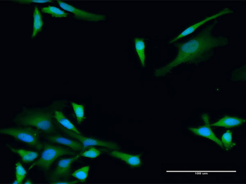 ADH5 purified MaxPab rabbit polyclonal antibody (D01P)