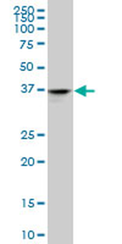 ADH4 monoclonal antibody (M03A), clone 1D2