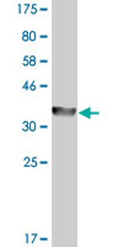 ADH4 monoclonal antibody (M03A), clone 1D2
