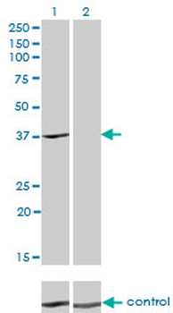ADH4 monoclonal antibody (M01), clone 3C5