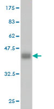 ADH4 monoclonal antibody (M01), clone 3C5