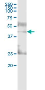 ADH4 MaxPab rabbit polyclonal antibody (D01)