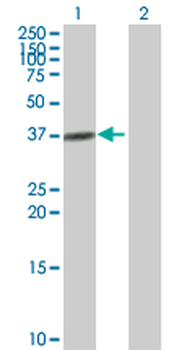 ADH4 purified MaxPab mouse polyclonal antibody (B01P)