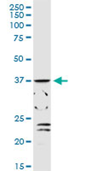 ADH1C MaxPab rabbit polyclonal antibody (D01)