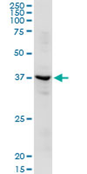 ADH1C MaxPab rabbit polyclonal antibody (D01)