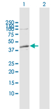 ADH1C MaxPab rabbit polyclonal antibody (D01)