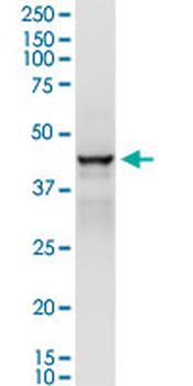 ADH1C MaxPab rabbit polyclonal antibody (D01)