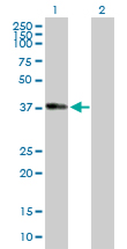 ADH1B purified MaxPab mouse polyclonal antibody (B01P)