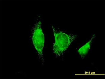 ADH1B purified MaxPab mouse polyclonal antibody (B01P)