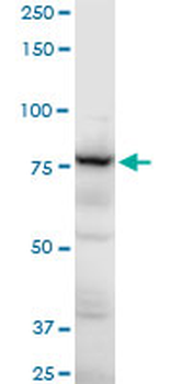 ADD3 polyclonal antibody (A01)