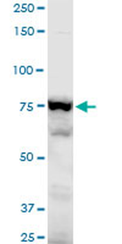 ADD3 polyclonal antibody (A01)