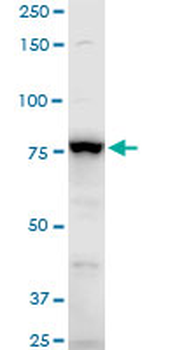ADD3 polyclonal antibody (A01)