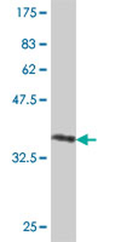 ADD3 polyclonal antibody (A01)
