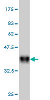 ADCYAP1R1 monoclonal antibody (M01), clone 2B12