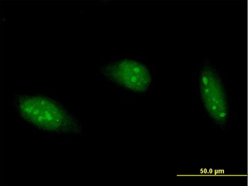 ADARB1 purified MaxPab mouse polyclonal antibody (B02P)