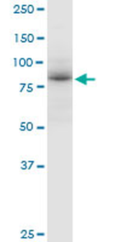 ADARB1 MaxPab mouse polyclonal antibody (B01)