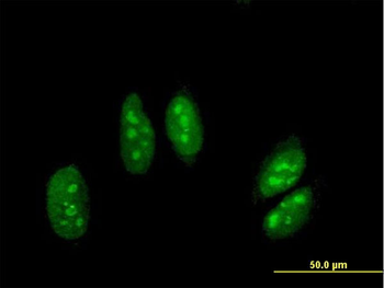 ADARB1 MaxPab mouse polyclonal antibody (B01)