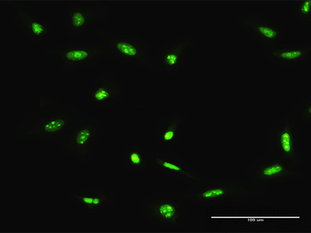 ADAR MaxPab rabbit polyclonal antibody (D01)