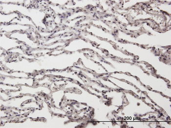 ADAR purified MaxPab mouse polyclonal antibody (B01P)