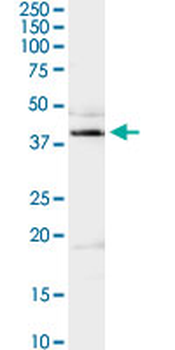 ADA purified MaxPab rabbit polyclonal antibody (D01P)