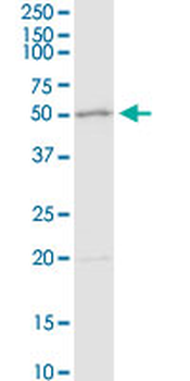 ADA purified MaxPab rabbit polyclonal antibody (D01P)