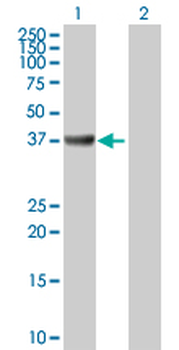 ADA purified MaxPab rabbit polyclonal antibody (D01P)