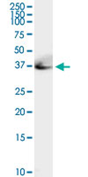 ADA MaxPab rabbit polyclonal antibody (D01)
