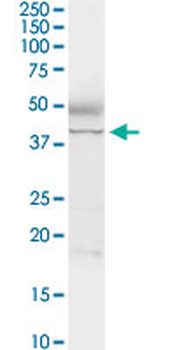 ADA MaxPab rabbit polyclonal antibody (D01)