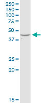 ADA MaxPab rabbit polyclonal antibody (D01)