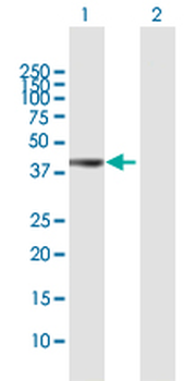 ADA MaxPab rabbit polyclonal antibody (D01)