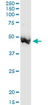 ADA MaxPab rabbit polyclonal antibody (D01)