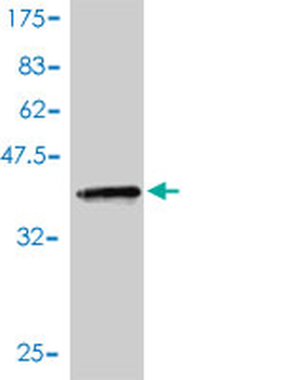 ACYP1 monoclonal antibody (M01), clone S3