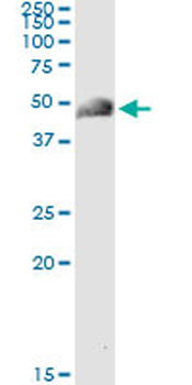 ACY1 monoclonal antibody (M02), clone 1A11-F6