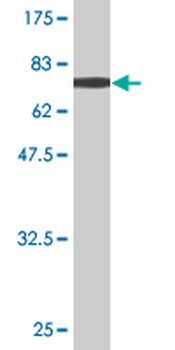 ACY1 monoclonal antibody (M02), clone 1A11-F6