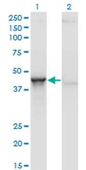 ACY1 monoclonal antibody (M01), clone 4F1-B7
