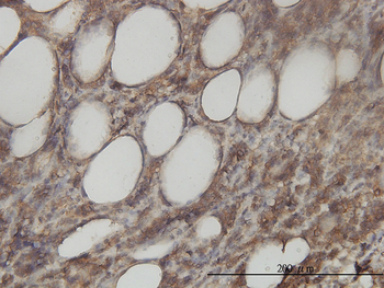 ACY1 monoclonal antibody (M01), clone 4F1-B7