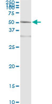 ACY1 monoclonal antibody (M01), clone 4F1-B7