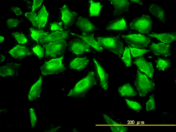 ACY1 monoclonal antibody (M01), clone 4F1-B7