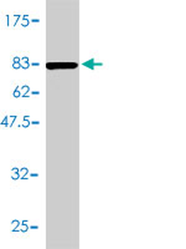 ACY1 monoclonal antibody (M01), clone 4F1-B7