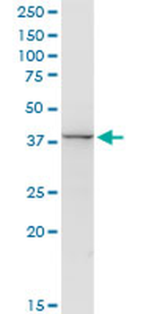 ACY1 purified MaxPab rabbit polyclonal antibody (D01P)