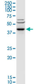ACY1 purified MaxPab rabbit polyclonal antibody (D01P)