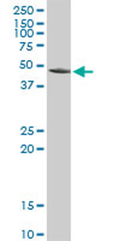 ACY1 purified MaxPab rabbit polyclonal antibody (D01P)