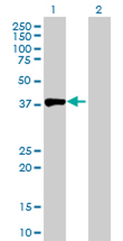 ACY1 purified MaxPab rabbit polyclonal antibody (D01P)