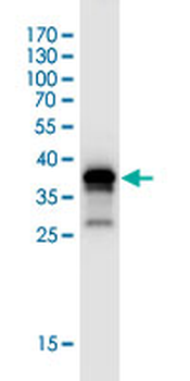 ACVR2B monoclonal antibody (M03J), clone 1C11