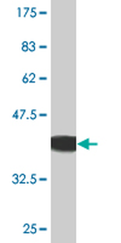 ACVR2B monoclonal antibody (M03), clone 1C11